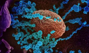 Covid-19: Mutațiile "neobișnuite" ale variantei Lambda